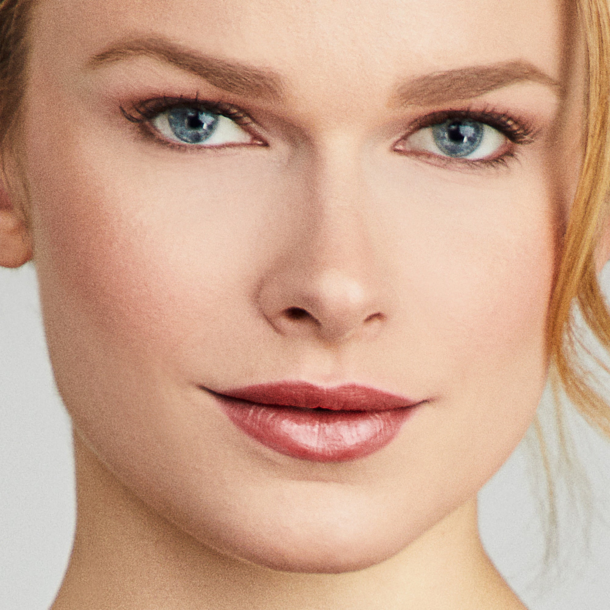 A Few Simple Solutions for Vertical Upper Lip Lines